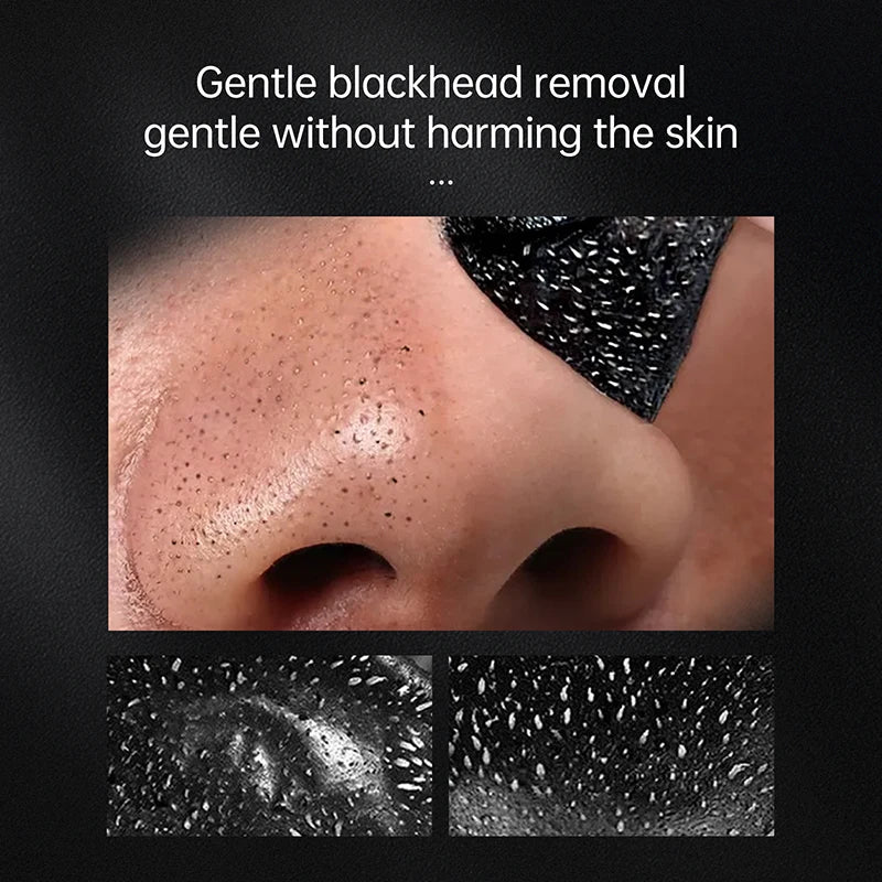 Cleanuest™ - Blackhead Remover Mask