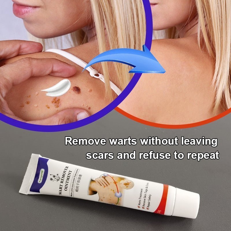 AntiWart™ - Painless Warts Solution - TumTum